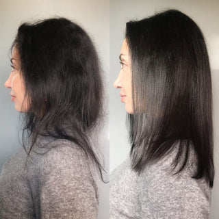 HAIR GROWTH BOOST THERAPY