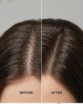 Scalp Detox Therapy – Deep Cleanse